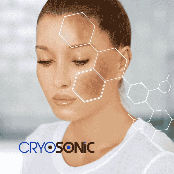 Are you looking for age spot removal treatment? Contact Cryosonic today in Canterbury