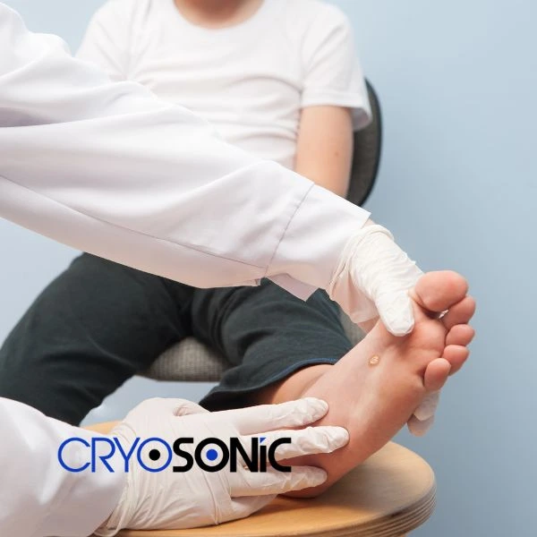 Are you looking for fast effective wart removal Contact us today Canterbury